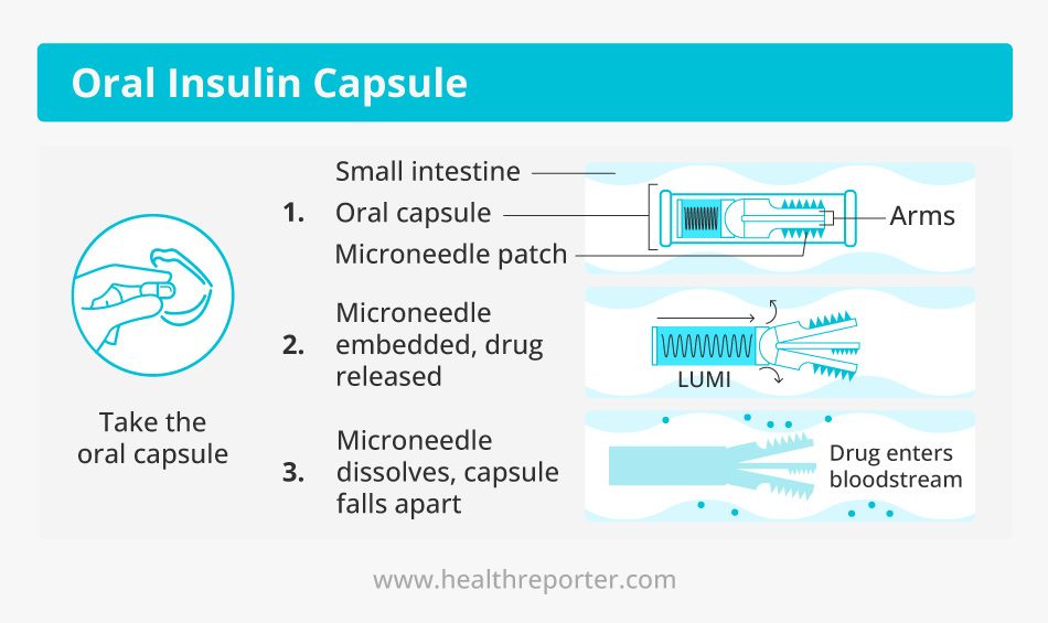 Insulin scandal findings