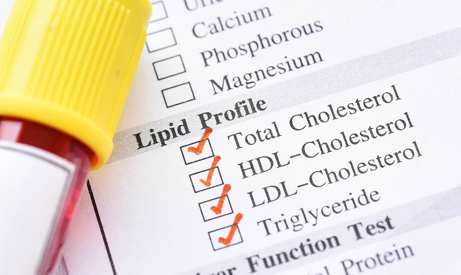 Cholesterol 101 - Myths, Facts, and What You Need to Know