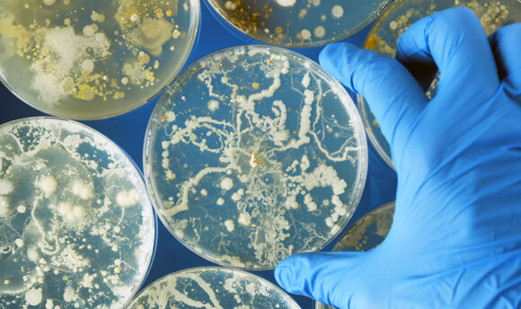 Expert FAQs on Candida Fungus Can The Last of Us Happen in Real Life