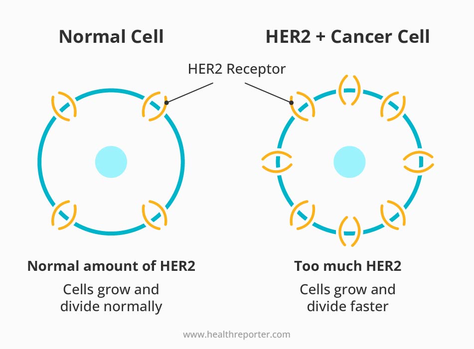 Her2 cells