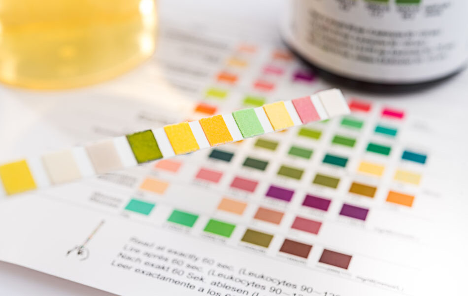 Ketone levels chart