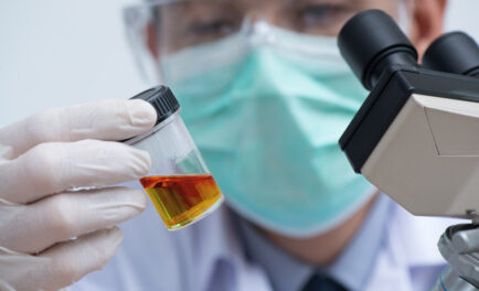 can stress cause blood in urine